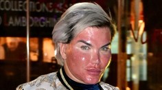 Nechcel vrásky, teraz vyzerá ako rajčina: Ľudskému Kenovi horí tvár