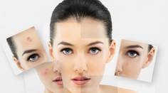 Takto pôsobí perióda na vašu pleť