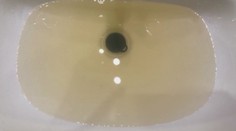 Obce v okolí Levíc trápi hrdzavá voda. Vodári tvrdia, že ide iba o estetický problém