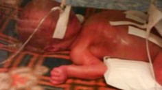 Alex sa narodil predčasne a vážil necelé kilo. Takto vyzerá malý bojovník dnes