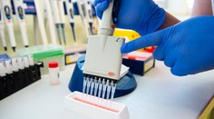 Delta variant naďalej dominuje, odhalili ho v takmer všetkých vzorkách