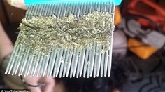 To, čo vyčesala matka 9-ročnej dcére z vlasov, vás šokuje