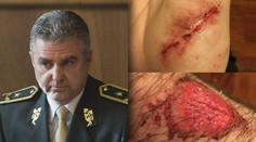 Pri zásahu policajtov sa zranil chlapec: Podľa Gašpara nedošlo k pochybeniu