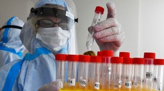 Problémy s testovaním pokračujú. Najviac sa čaká na výsledky testov