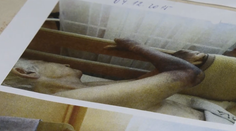 Starenka mala otrasné preležaniny. Teraz sa sporia, kto za to môže