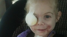 Dohryzené dieťa (3) vyhodili z fast foodu. Vraj desilo zákazníkov