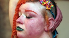 Žena trpí neuveriteľnými bolesťami. Horí zvnútra