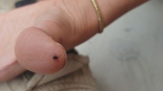 Slovensko je semeniskom zákernej kliešťovej choroby. Nakazených je stále viac, takto sa dá brániť