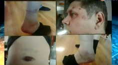 Vraj sa na ňom bitkou vyzúrili policajti. Jeho žena ale tvrdí, že ju týral