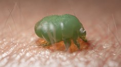 Svrab máme aj na Slovensku. Nakazilo sa ním už takmer tristo ľudí