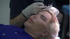 Najznámejší Ken všetkých šokoval: Po plastikách prišla najradikálnejšia premena