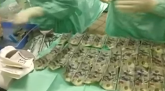 Podvedená manželka zjedla takmer 6500 eur. Lekári zachránili 5000, zvyšok už bol natrávený