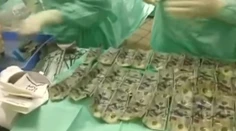 Podvedená manželka zjedla takmer 6500 eur. Lekári zachránili 5000, zvyšok už bol natrávený