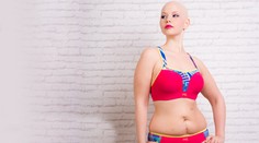 Modelka kyprých tvarov Elly Mayday je po chematerapii späť pred objektívmi