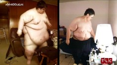 Lekári ho varovali pred smrťou. Morbídne obézny muž zhodil viac ako 190 kíl