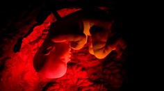 Užasný výkon lekárov! Žena v kóme porodila zdravého chlapca