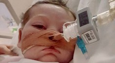 Je koniec, malý Charlie Gard zomrie. Rodičia svoj boj o záchranu syna vzdali