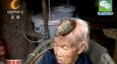 Žene vyrástol na hlave roh