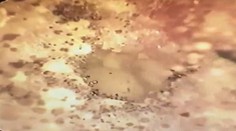 VIDEO: Pacient sa sťažoval na nedoslýchavosť. Keď lekár prezrel ucho, zostal v šoku