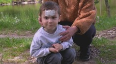 Adamko (3) sa rozbehol za kačicami, o pár sekúnd tiekla krv. Pokojné popoludnie v Tlmačoch sa zmenilo na chvíle hrôzy