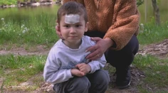 Adamko (3) sa rozbehol za kačicami, o pár sekúnd tiekla krv. Pokojné popoludnie v Tlmačoch sa zmenilo na chvíle hrôzy