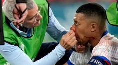 Mbappé príde pre zlomeninu nosa minimálne o zvyšok základnej skupiny, píše francúzsky denník