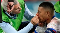 Mbappé príde pre zlomeninu nosa minimálne o zvyšok základnej skupiny, píše francúzsky denník