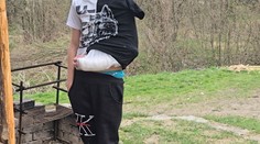 Nerovný súboj pred školou. Do strkanice medzi deťmi sa mal zapojiť rodič, chlapec skončil so zlomenou rukou