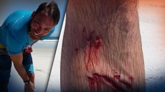 Surfista mal obrovskú smolu: Keď vyskočil z vlny, dopadol priamo na žraloka