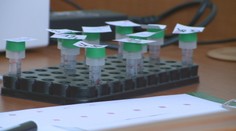 Jednorazovky, teda sex na jednu noc, sú zrejme väčším rizikom, ako Slováci predpokladajú. Syfilis láme rekordy