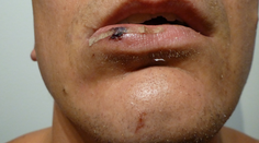 Podozrenie z brutality. Policajt mal skočiť na hlavu onkologickému pacientovi