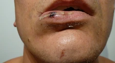 Podozrenie z brutality. Policajt mal skočiť na hlavu onkologickému pacientovi