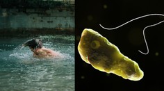 Lekárka tvrdí, že nie je dôvod na obavy z kúpania. Smrtiaca améba chlórovanie neprežije, no nakaziť sa dá aj inak