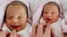 Lekári zostali v šoku. Na strednom Slovensku sa narodilo bábätko so zubom