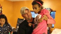 Linda si dala v 18-tich rokoch zväčšiť prsia, skončila v kóme