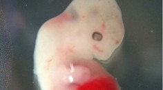 Prvýkrát v histórii vedci vytvorili ľudsko-zvieracie hybridné embryo