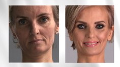 Nové zuby aj prsia! Z čašníčky Jany je po premene hotová modelka