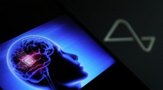 Prvý pacient, ktorý má v mozgu čip od Muskovho Neuralinku, dokáže ovládať mysľou myš počítača