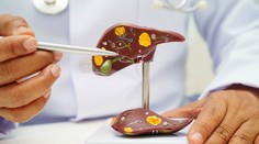 Rozmáha sa ťažká choroba. Varovné signály Slováci objavujú neskoro