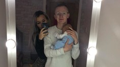 Mamička si pred dojčením nezmyla samoopaľovací krém. Jej syn teraz vyzerá ako Homer Simpson