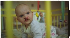 Kruté dedičstvo Černobyľu! Aj 28 rokov po výbuchu trpia tí najnevinnejší