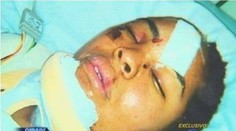 Šialenec sotil mladú ženu (27) pod metro. Odtrhlo jej to ruku