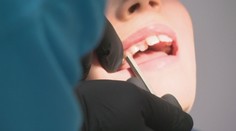 Termíny sa plnia, oneskorenci si budú platiť zubára sami. Lekári varujú pred koncom roka