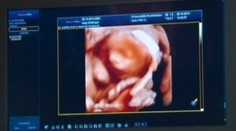 Tehotná si môže pritúliť dieťa ešte pred narodením. Je tento nápad zvrátený?