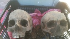 Muž v Gbeloch kopal základy pre garáž, našiel ľudské lebky a zuby