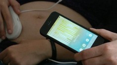 Máte nápad? Investori majú na tie najlepšie pripravený milión