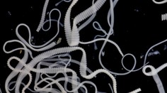 Muž sa sťažoval na veľké bolesti. V mozgu mu našli 700 lariev pásomnice