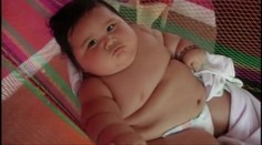 Najtučnejšie dieťa Kolumbie. Má osem mesiacov a 25 kíl