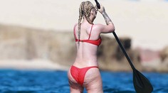 Toľko celulitídy ste pokope asi nevideli. Tomuto zadku nepomohla ani plastika