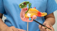 Väčšina pacientov s rakovinou pankreasu nemá šancu prežiť. Tri skupiny ľudí sú najviac ohrozené